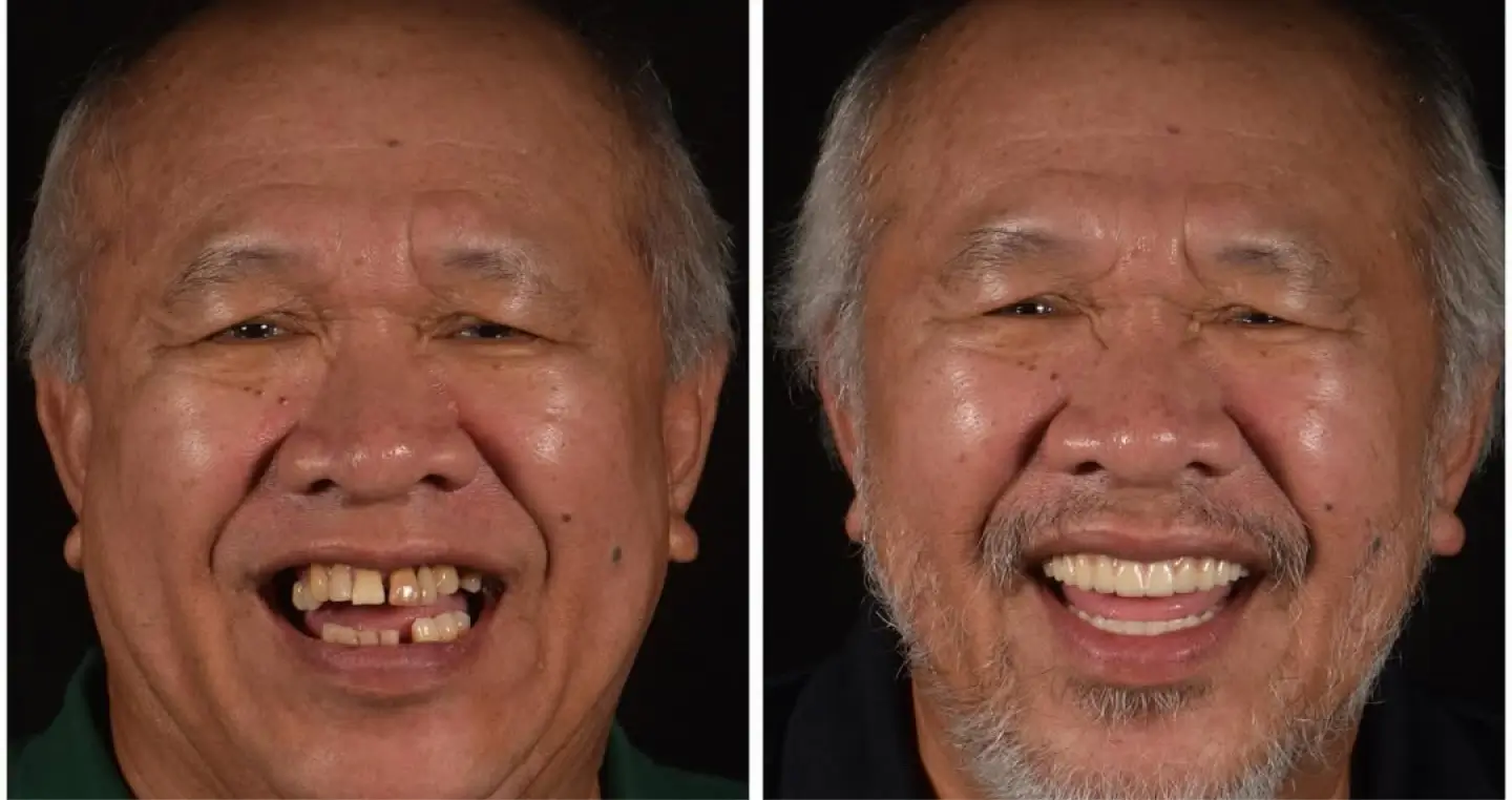 beore-ater-image Before-After Image