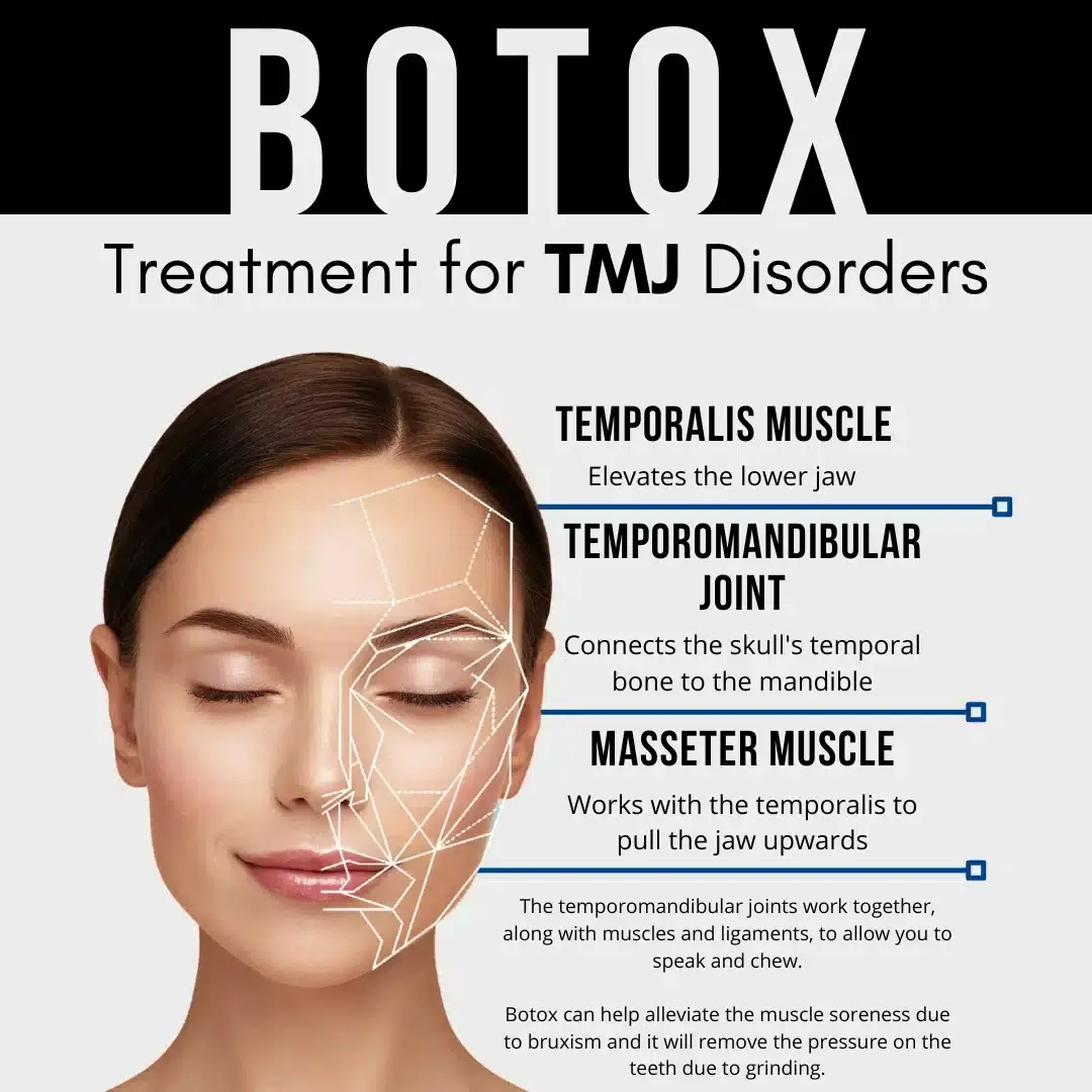 Who Can Benefit from Botox Treatments?